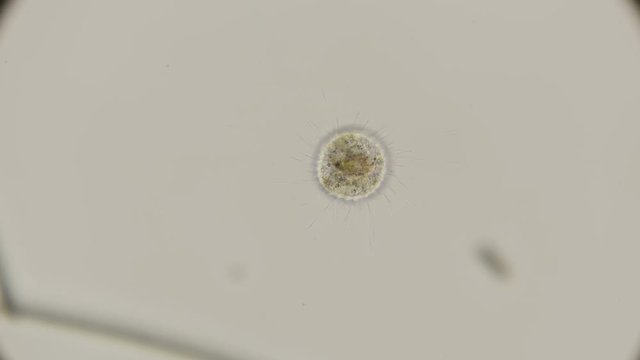 microorganism Heliozoa, Acanthocystis under the microscope