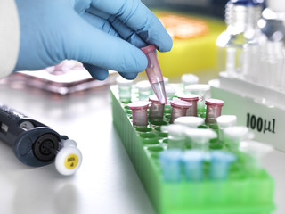 Cropped hand of scientist putting eppendorf containing scientific sample in rack