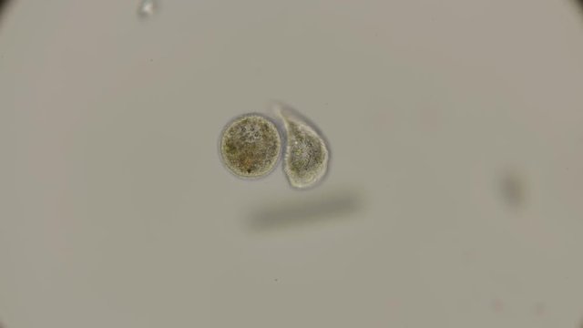 microorganism Heliozoa, Acanthocystis grabbed prey under a microscope