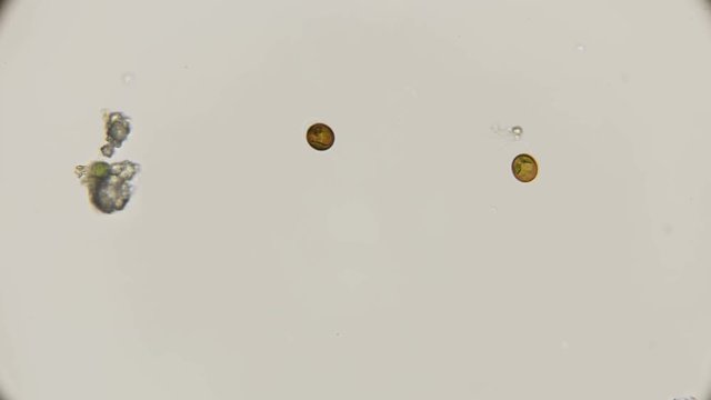 algae Trachelomonas botanists with a moving flagellum under a microscope