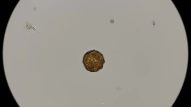 egg-worm parasitic nematodes under the microscope