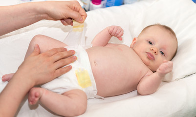 Portrait of baby during diapers change