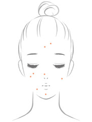 ニキビに悩む女性