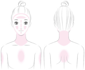 ニキビのできやすいところ