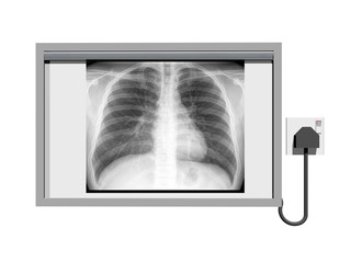 Röntgenbild Betrachter mit Röntgenbild