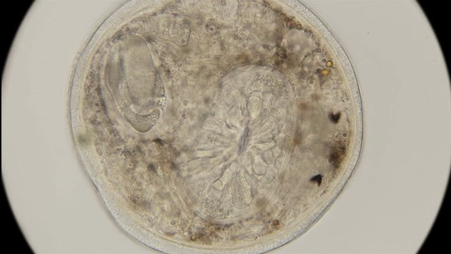 the movement of the flat worm Planariidae in which the body is formed in round shape under a microscope