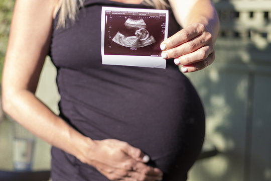 Pregnant Woman Holding an Ultrasound Picture of her Baby