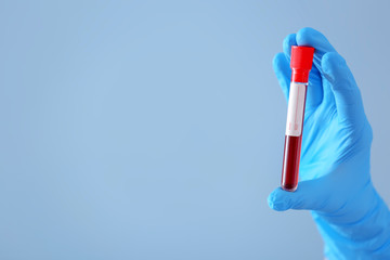 Lab worker holding test tube with blood sample on color background