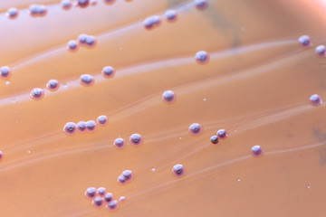 Colony Characteristics of Escherichia coli (E. coli) is a Gram-negative, facultatively anaerobic,...