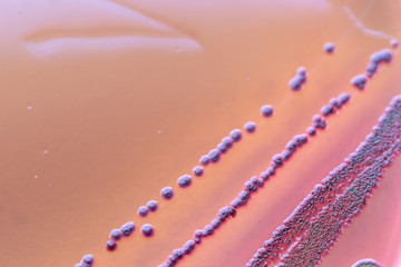 Colony Characteristics of Escherichia coli (E. coli) is a Gram-negative, facultatively anaerobic,...