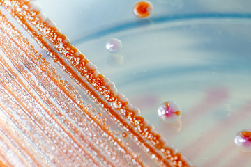 Serratia marcescens is a species of rod-shaped gram-negative bacteria in the family...