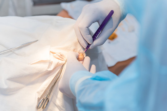 hands of surgeon doctor doing surgery on woman's toe. Concept photo of professional medicine