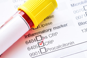 Blood sample tube with laboratory requisition form for C-reactive protein (CRP) test
