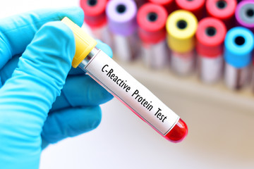 Blood sample tube for C-reactive protein (CRP) test
