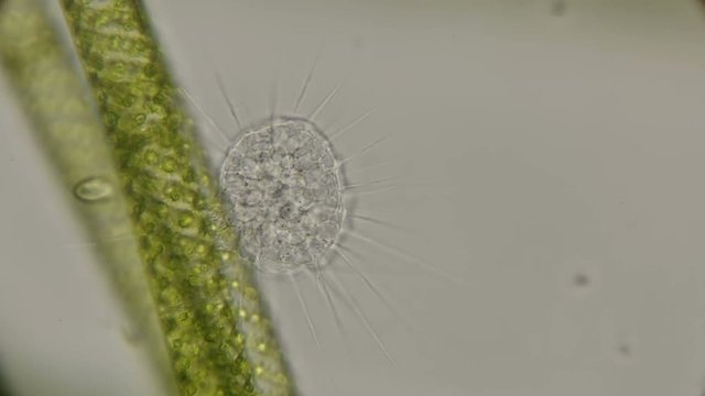 the simplest organisms of the Heliozoa class, similar to radiolarians, under a microscope