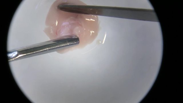 microscope mouse brain dissection with scalpels, close up continued