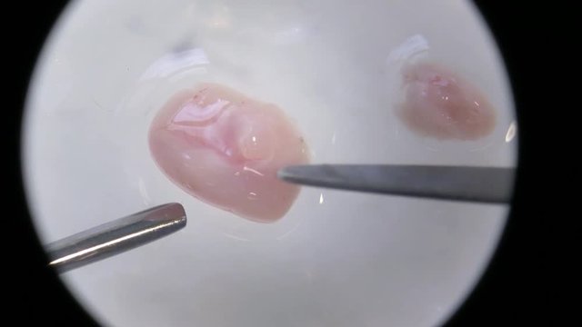microscope mouse brain dissection scalpel hippocampus close up continued