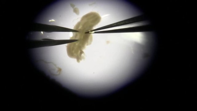 researcher scientist microscope mouse brain dissection forceps, continued, close up
