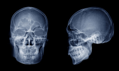 Very good quality X-ray image of normal human skull front (AP) view and side (Lateral) view, Process in blue tone isolated on black background.