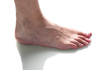 Fototapeta premium Cropped view of tired feet