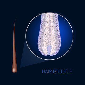 Hair bulb under the microscope. Follicle structure closeup. Removal, treatment and transplantation concept. Medical educational symbol. Body anatomy vector illustration.