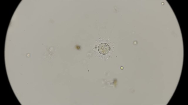 Infusoria Podophrya under a microscope