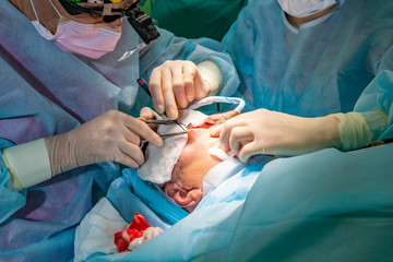 Plastic surgery in operating room