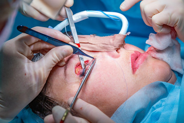 Plastic surgery in operating room