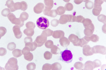 White blood cells in blood smear, analyze by microscope
