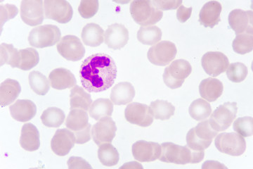 White blood cells in blood smear, analyze by microscope
