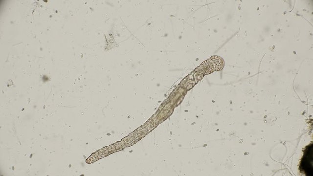 worm of the family Aeolosomatidae, Aeolosoma hemprichi, under the microscope