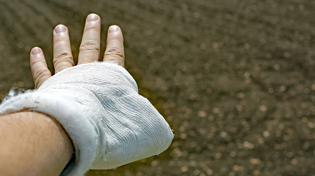 hand plastered due to a domestic accident indicates the fields