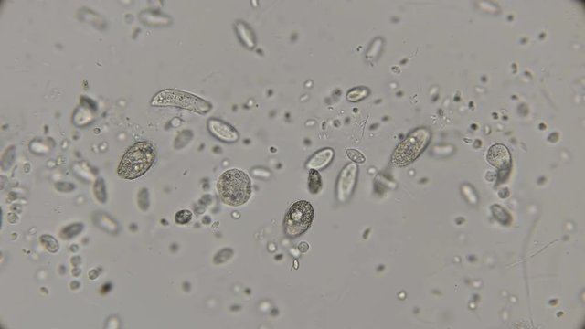 a large colony of various protozoa under a microscope