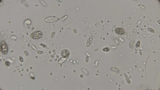 accelerated movement of a large colony of various protozoa under a microscope