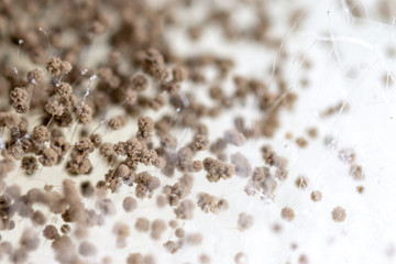 Rhizopus (bread mold) is a genus of common saprophytic fungi,Rhizopus (bread mold) under the microscope.