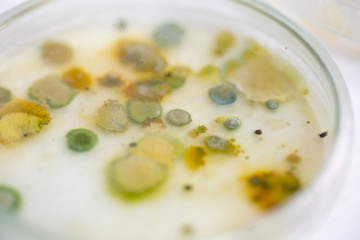 Backgrounds of Colony Characteristics of Fungus and algae in petri dish for education.