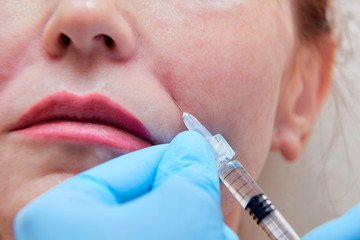 Injection cosmetology. Biorevitalization Procedure.  Closeup of hands in gloves holding syringe. Female Face. Beauty salon