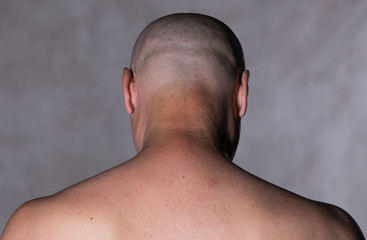 Obraz premium studio portret łysego mężczyzny na czarnym tle