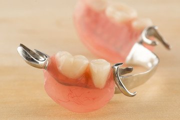 arc dental prosthesis