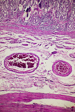 human stomach gastric mucosa intestinal metaplasia