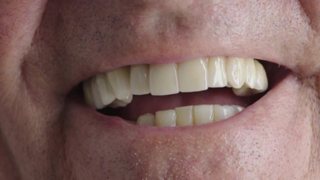 close up of elderly man mouth laughing healthy teeth