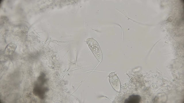 vorticella living in water with oxygen deficiency, under a microscope