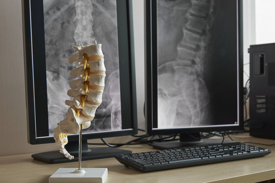 Human lumbar spine model and background of x-rays lumbar spine