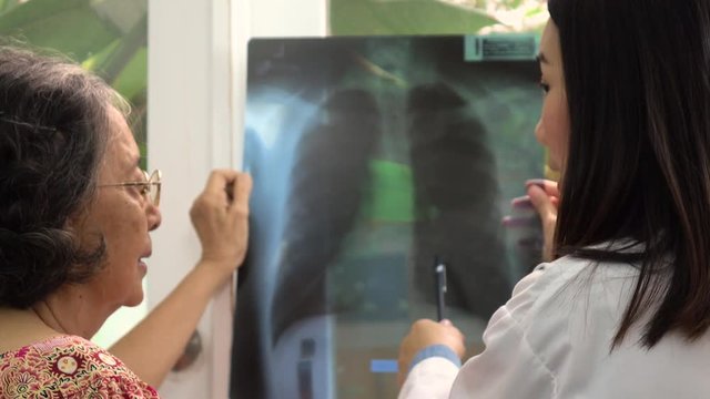 Doctor explaining x-ray film to her patient, Healthcare and Medical Concept