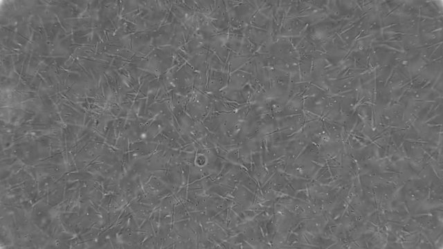 colony of spirochete, rod-shaped bacteria and other bacteria living in dirty, rotten water, under a microscope