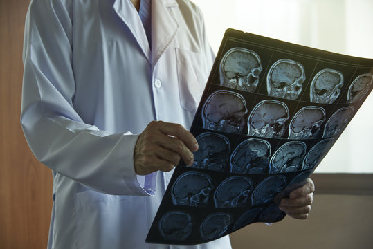 Doctor holding brain MRI in medical office