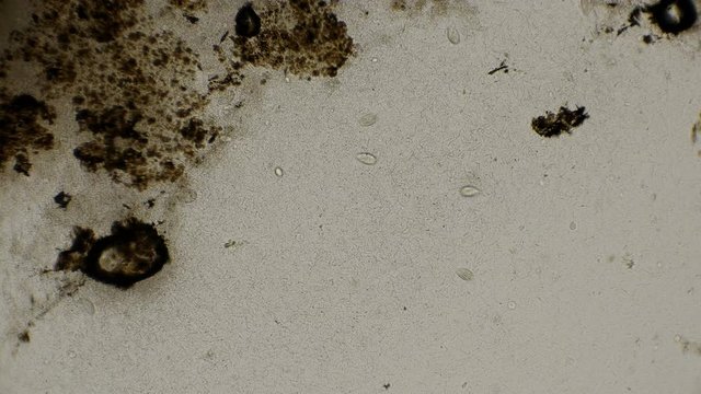 colony of rod-shaped bacteria, spirochet in a drop of dirty water, under a microscope