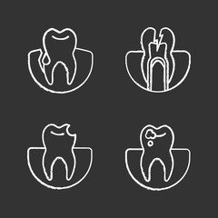 Dentistry chalk icons set
