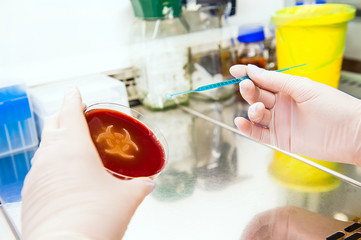 Microbiology biohazard - bacteria culture