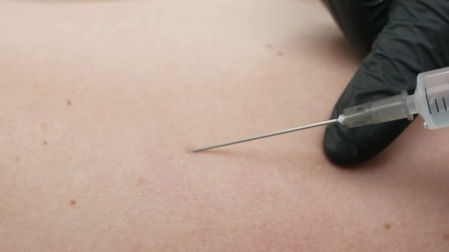 Doctor giving an injection to a patient. Closeup of injection vaccine. Close-up liquid substance in syringe. Doctor treating patient against dangerous disease. Health care industry